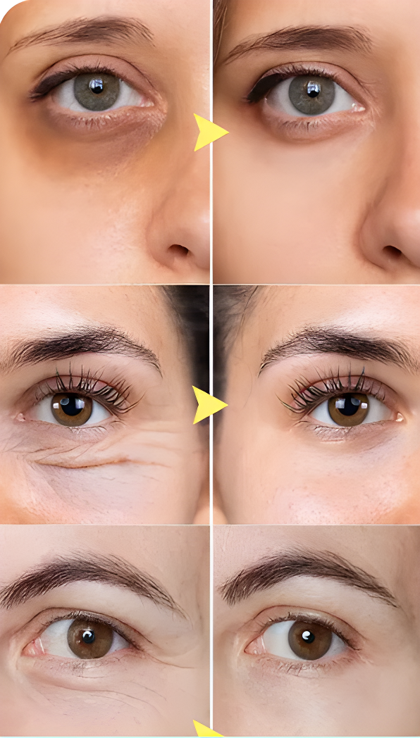 Rejuvenating Hydra Eye Patches™