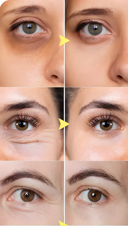 Rejuvenating Hydra Eye Patches™